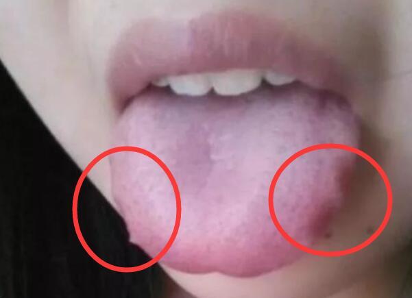 因而舌头的齿痕变化亦可看出一个人的肾脏健康与否.
