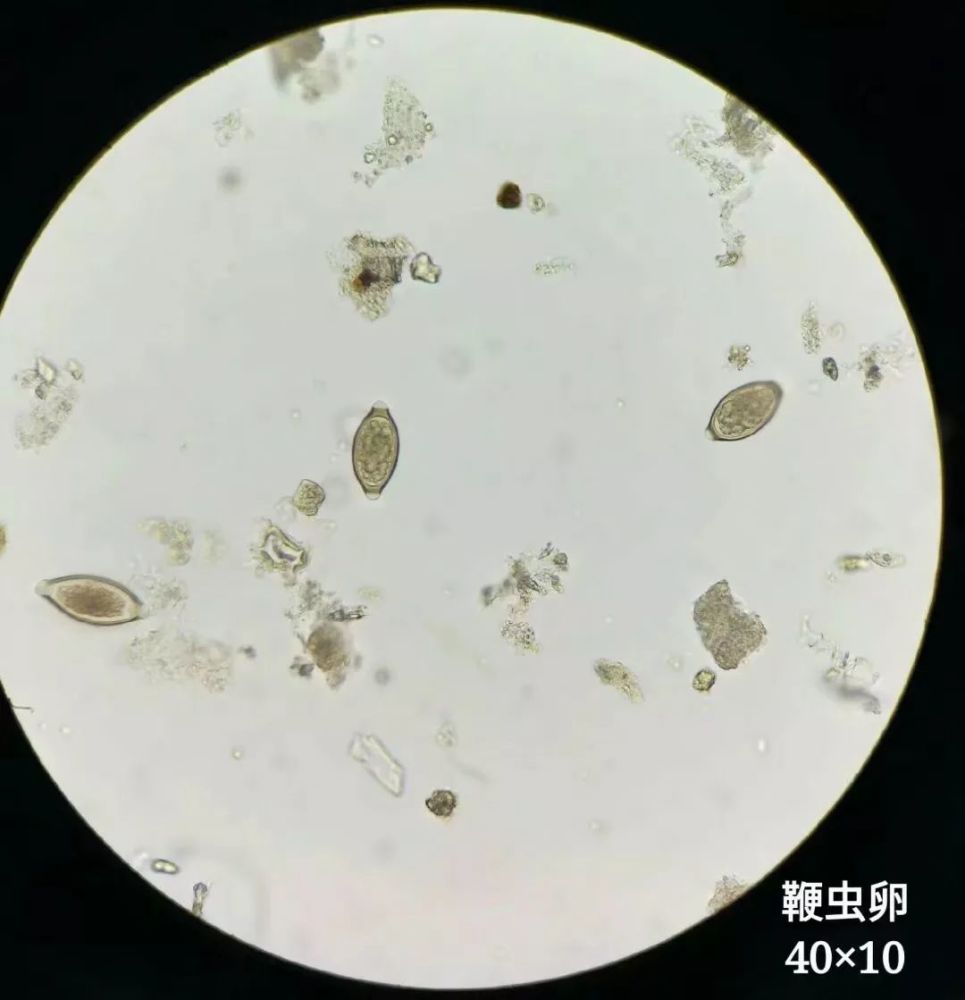 收藏!显微镜下的微观世界(寄生虫)