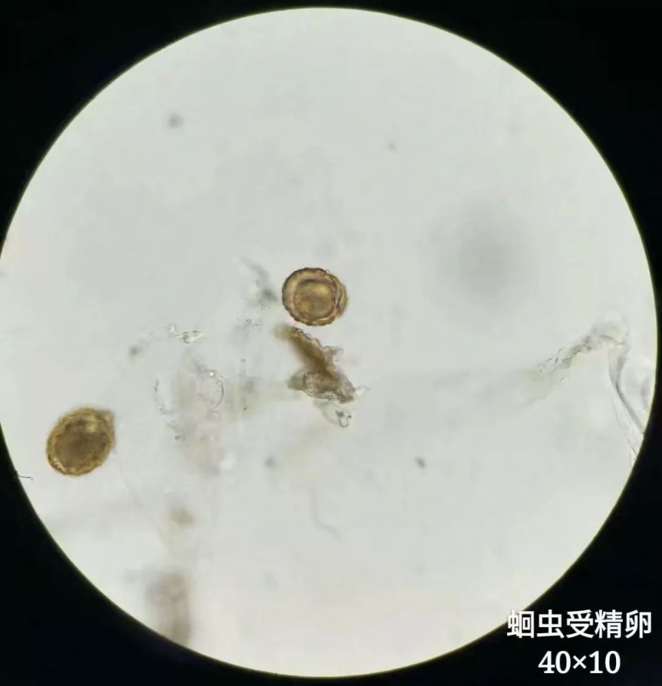 收藏!显微镜下的微观世界(寄生虫)