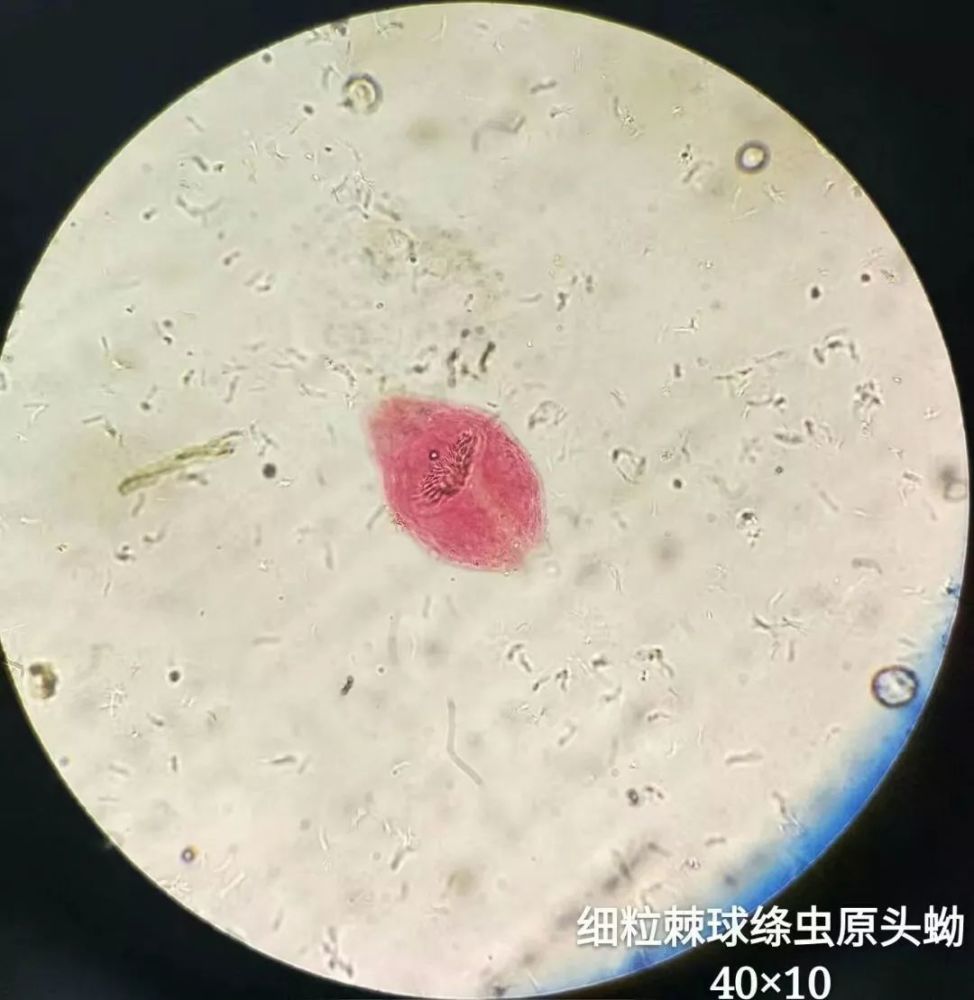 收藏!显微镜下的微观世界(寄生虫)