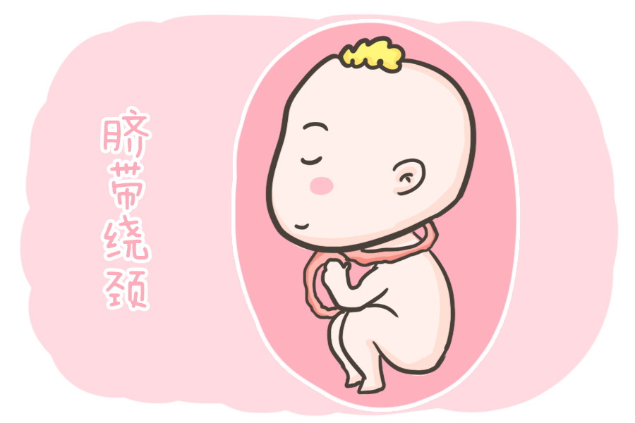 怀孕之后,孕妈该如何预防胎儿脐带绕颈的情况呢?这几点要搞清楚