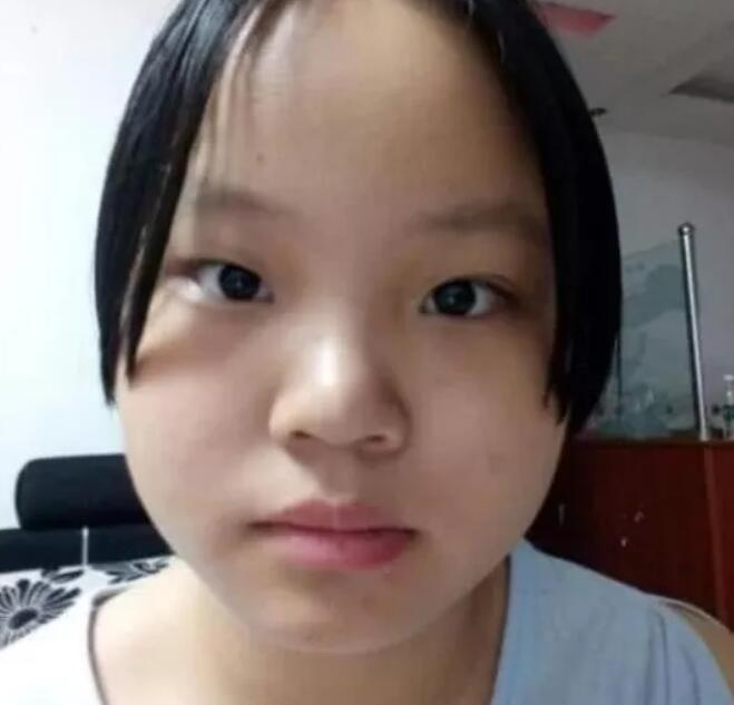有一张方脸的话是非常难看的,因为需要通过各种方式去遮掩自己的脸型