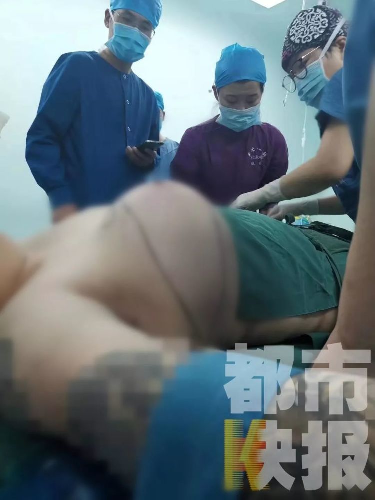 可怕!25岁男子胸竟比足球还大,西安医生花了6小时才切掉.