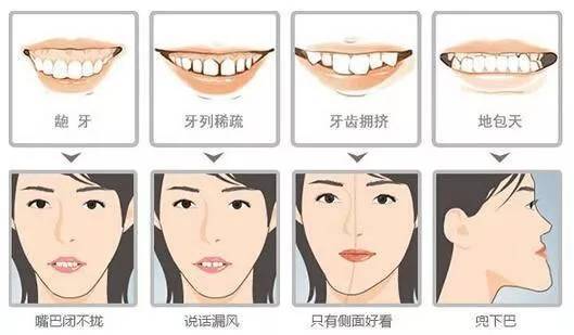 看什么样的牙齿需要矫正: 地包天,上颌前突,下颌后缩,牙齿内倾, 龅牙