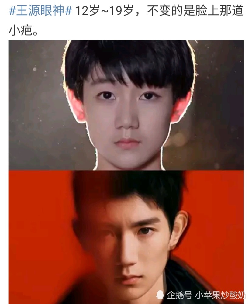 王源12岁19岁脸部特写,网友:不变的是那条伤疤!