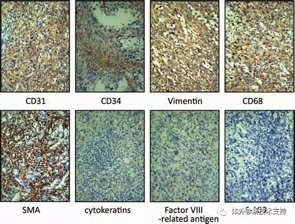 技术篇——免疫组化&病理诊断