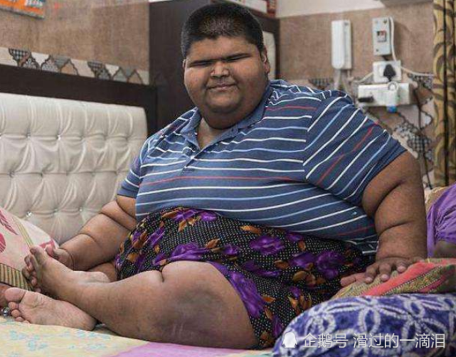 世界上最胖小孩,年仅10岁体重已超300斤,最后减肥成功