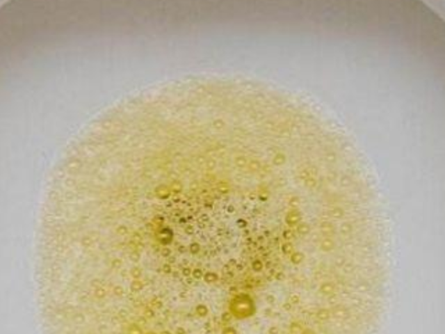 若发现自己的尿液中有泡沫且经久不散,可能是尿液中含有蛋白质,而这些