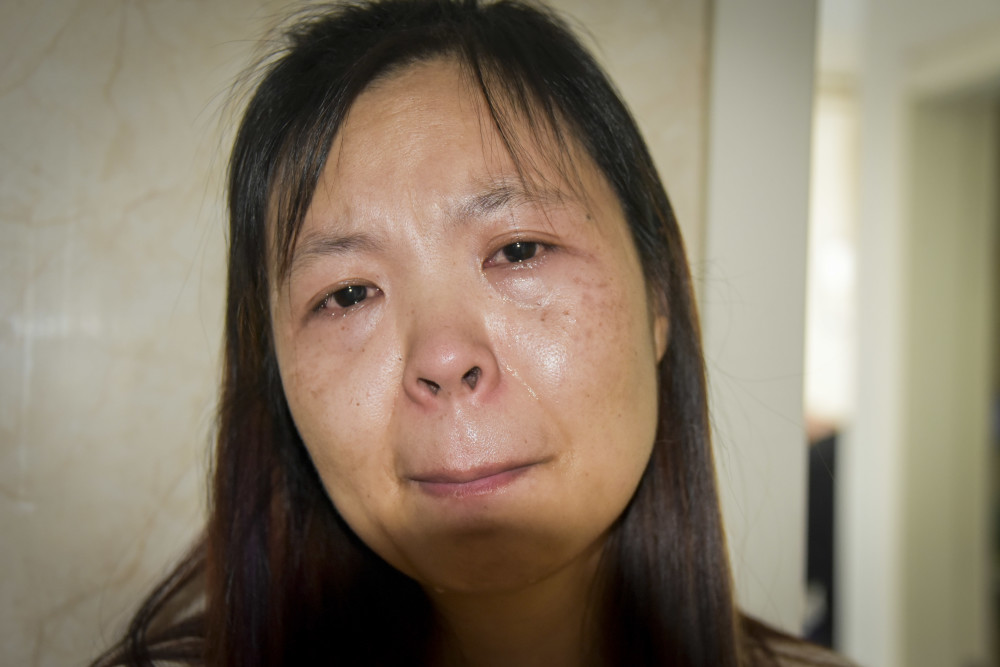 14岁花季少女因病眼睛即将失明,治疗的关键时刻父亲却
