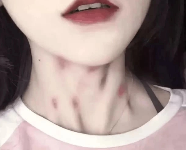 脖子