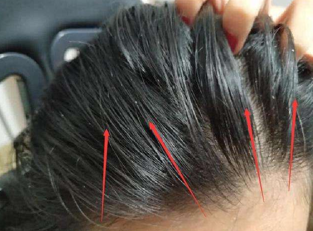小仙女"洗头"时,尽量戒掉这3陋习,当心头发会"越洗越油"