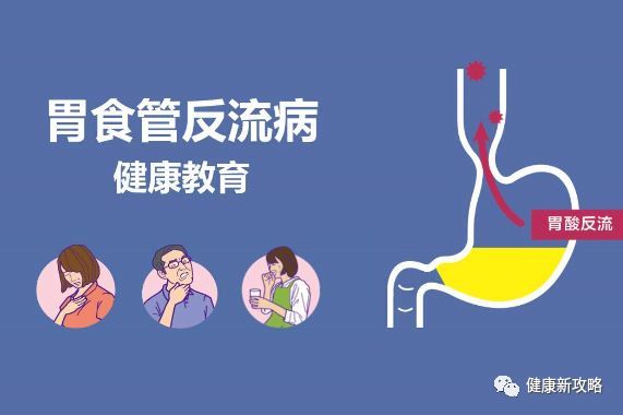 咳嗽长期不愈可能是胃食管反流病,2种方法调治