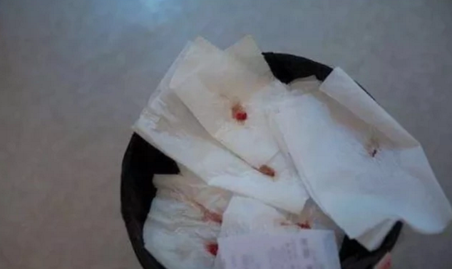 女生"特殊期",排出像肉一样的"血块"?离不开这3原因,请务必重视!