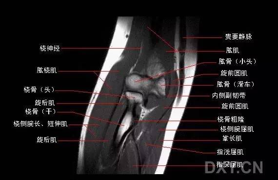 桡尺背侧韧带,三角纤维软骨,掌侧桡尺韧带,尺腕韧带,尺侧副韧带,以及