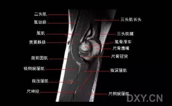 桡尺背侧韧带,三角纤维软骨,掌侧桡尺韧带,尺腕韧带,尺侧副韧带,以及