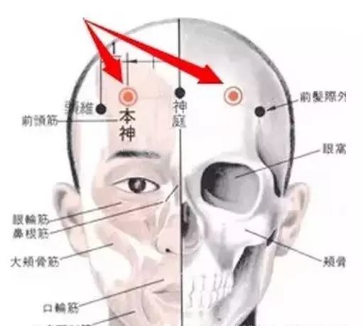 本神穴:头痛,目眩,癫痫