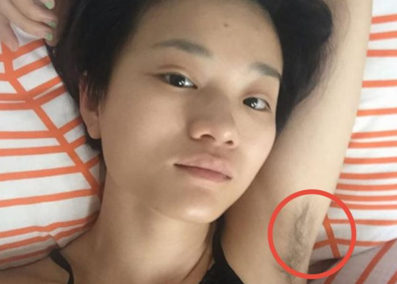 为啥有的女生腋下"不长毛"?一般逃不过"这3点",看完你