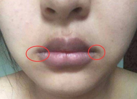 在中医理论看来,女性朋友的嘴唇应该是非常红润的,但是如果出现了