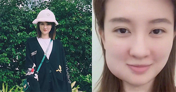 有种毁容叫明星拔智齿乔欣刘宪华没啥看到周冬雨笑了