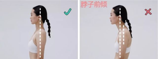 这4 种体态让人变丑,很多人都中招,赶紧改