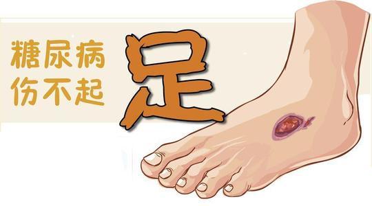 糖尿病足真的危害这么大吗?失去脚只是"白银"