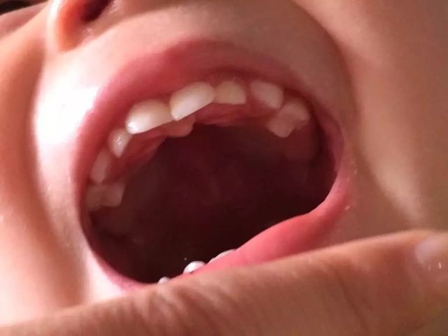 详解:宝宝的长牙时间,一张图让你秒懂宝宝长牙顺序