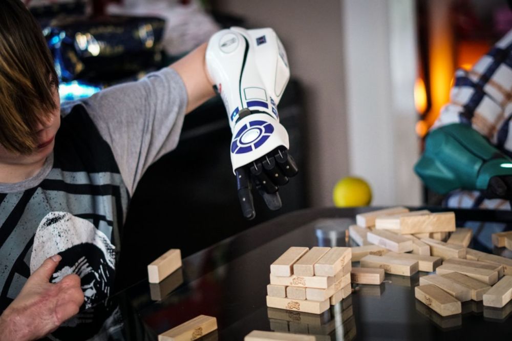 两小伙与机器人掰手腕骨折 腾讯网