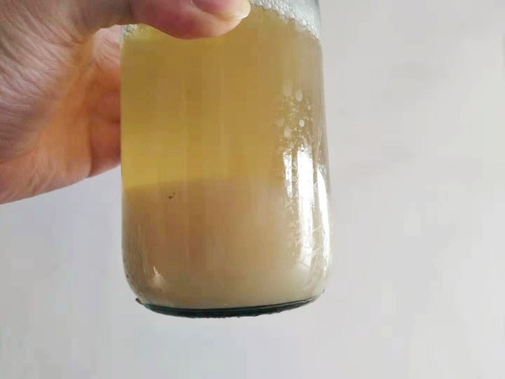 尿液是肾功能的试金石3种变化是肾病好转预兆