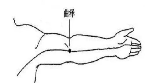 【穴位图】曲泽穴,急性胃肠炎必用穴