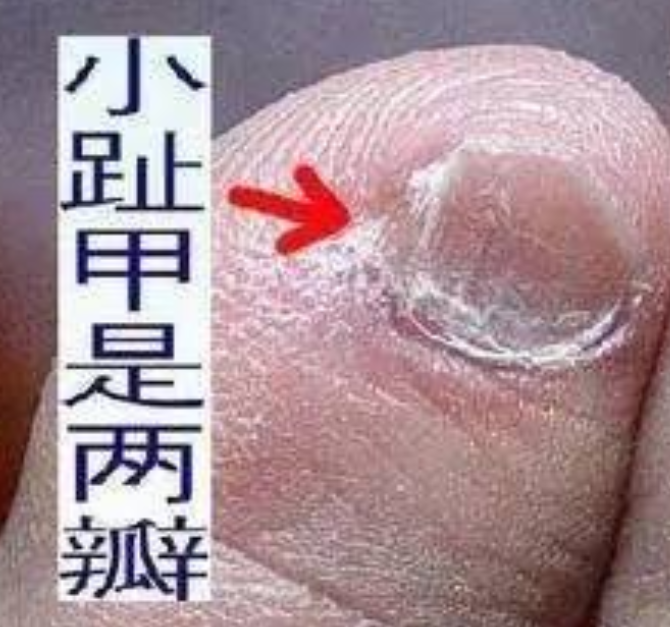 如果你脚趾上有这个特征,那你可能不是正宗汉族人,而是鲜卑人后代