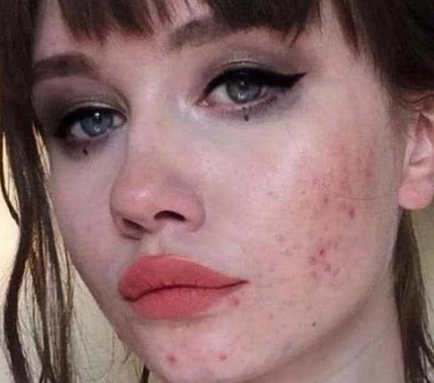 有"妇科病"的女孩子,脸上通常会有这"3丑态,藏是藏不住的!