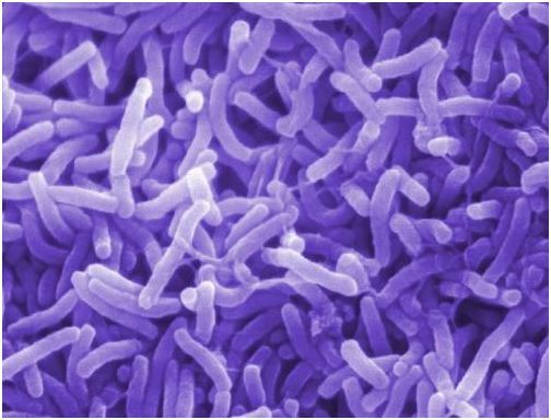 炭疽杆菌 bacillus anthracis 第三种叫做螺旋菌,成螺旋状或者弧形