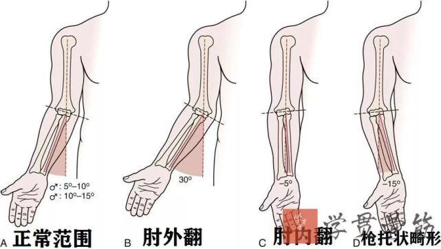 正常范围:男性10~15,女性20~25,比正常范围增大时为肘外翻