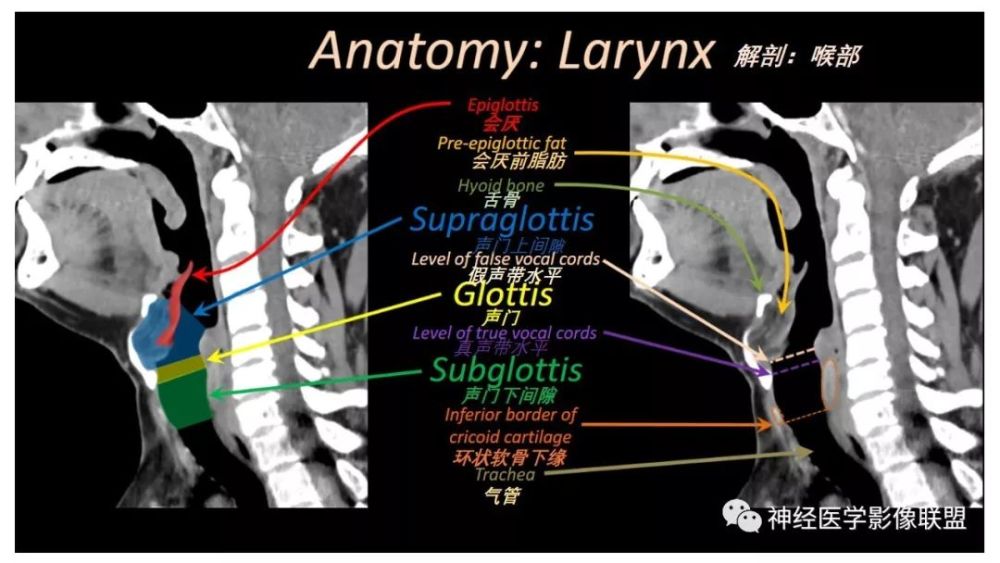 喉部ct解剖-简单!