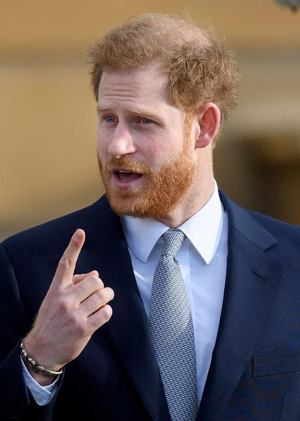 英国皇室秃头基因太强大!哈里王子脱发翻倍,去加拿大前不忘植发