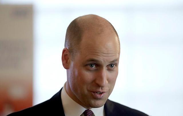 英国皇室秃头基因太强大!哈里王子脱发翻倍,去加拿大前不忘植发