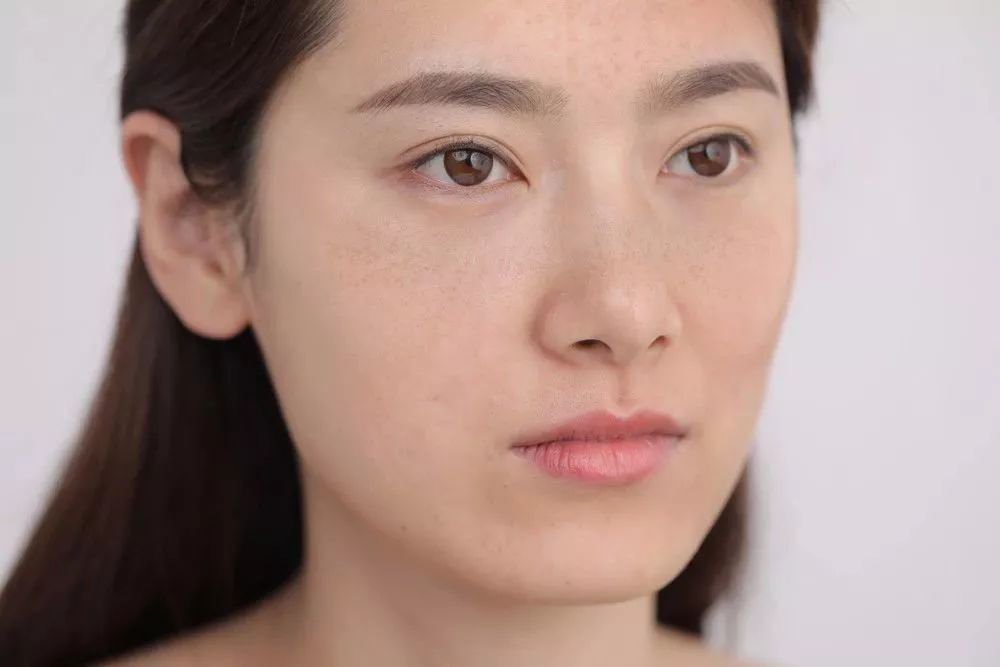皮肤科医生:春季黄褐斑女性4不吃,容易加重色斑,加速衰老