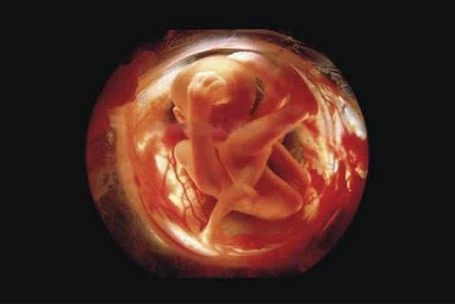14,怀孕20周,胎儿体型大约有20厘米了,头上开始长出一些毛茸茸的胎毛.