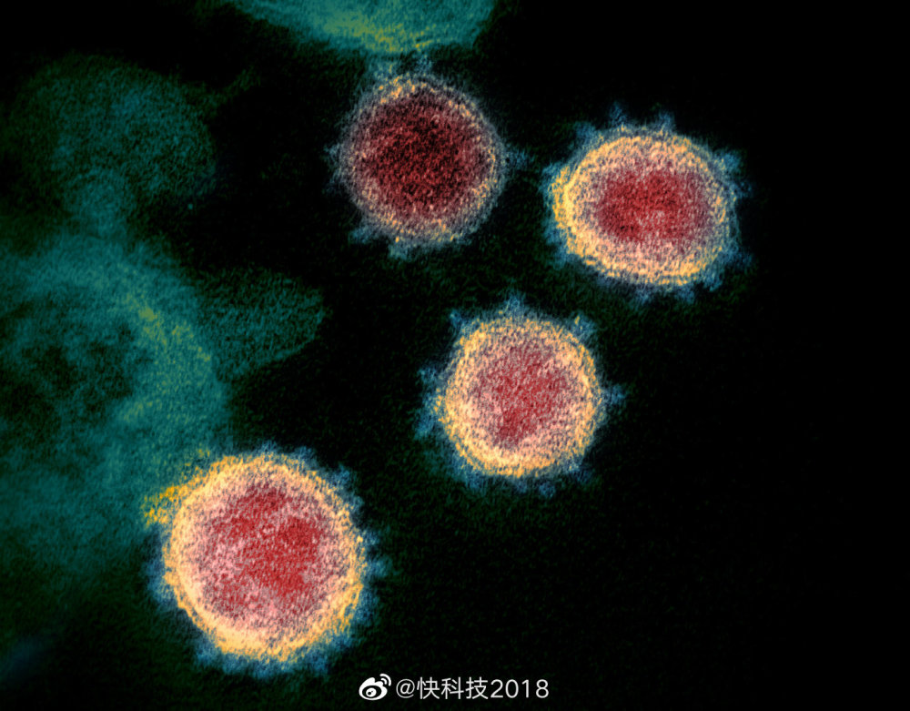 长这样!新冠病毒显微镜彩照首度公布,与mers和sars相似