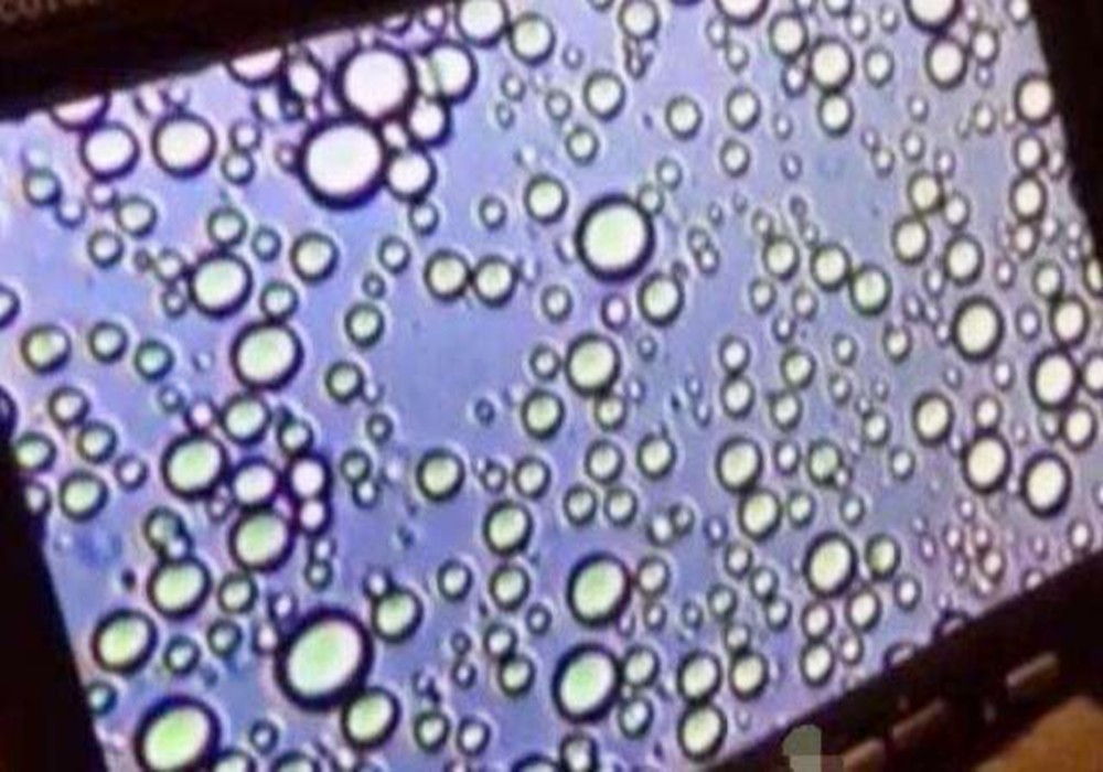 母乳放大1000倍是啥样子?显微镜下全活了,满满的营养脂肪粒