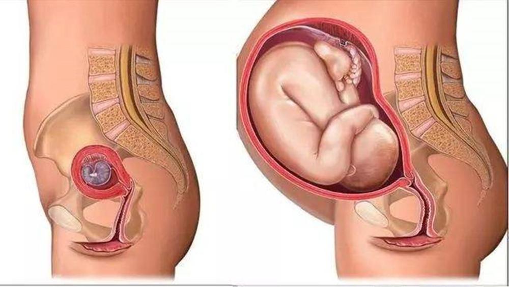 临近预产期时,胎儿头的位置逐渐向下移,会压迫到孕妇的骨盆.