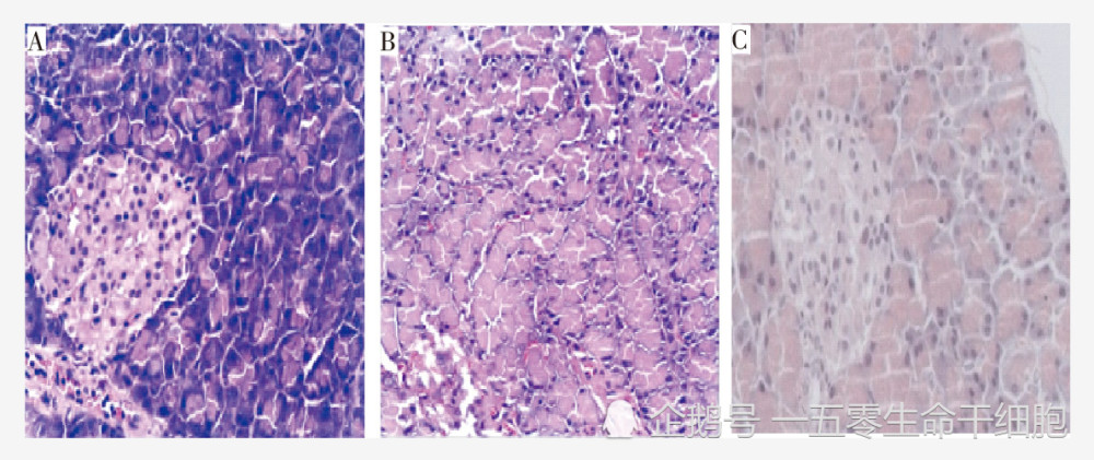 胰腺组织切片(a:空白组b:模型组c:干细胞组)