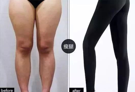 闫妮瘦身效果明显，瘦了30斤后大妈变姐姐，紧身衣也难不倒好身材