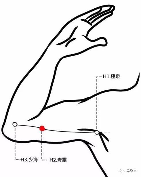 少海穴:心痛,肘臂挛痛,瘰疬
