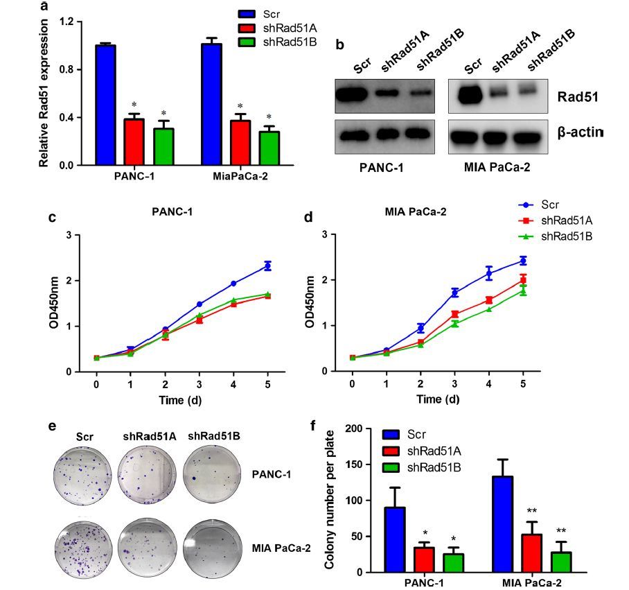 研究人员建立pan51-1和mia paca-2沉默rad51模型