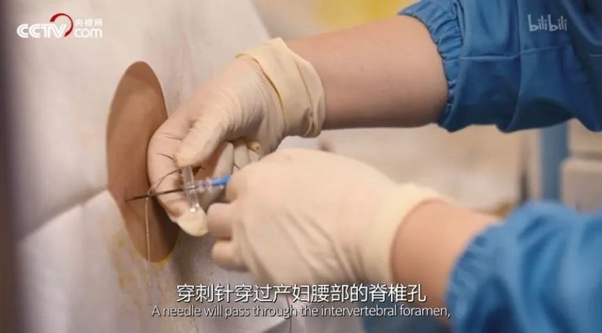 疼痛并没有结束,短暂的休息之后,又在分娩时加倍升级.