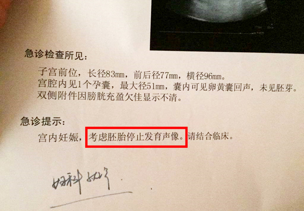 怀孕10周看不到胎心,是胎儿发育不好吗?孕早期做好4点