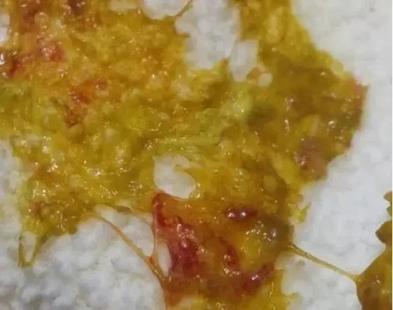 如何从便便来观察宝宝的健康状况