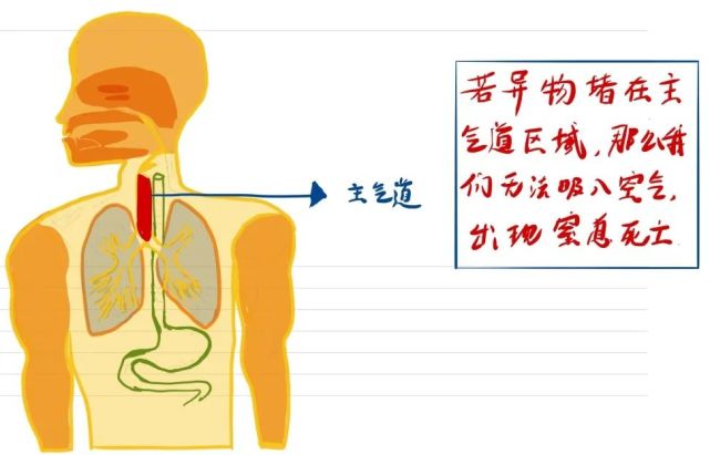 如果进入气道的异物比较大,直接卡住主支气管就会导致我们无法吸入