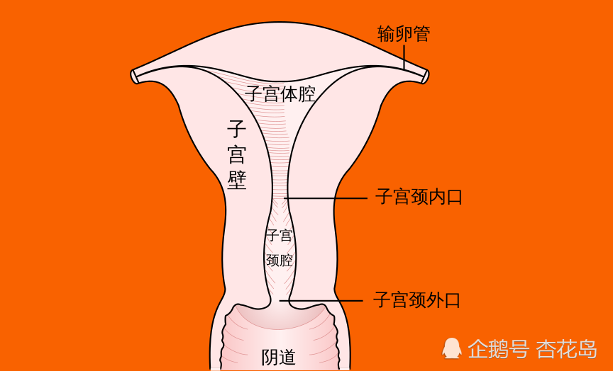 夫妻生活不当会伤害宫颈?知道3个解决办法,受益终生